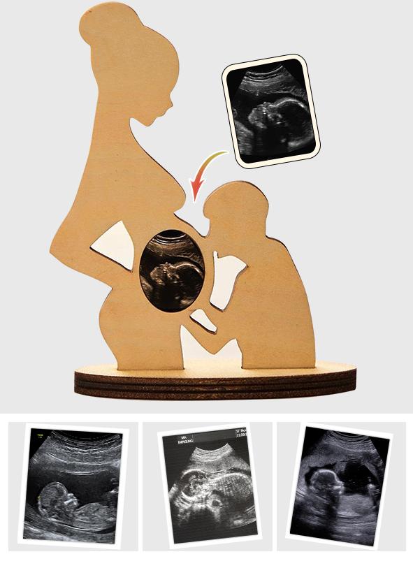 Any B-scan Newborn Photo - Personalized Pregnancy B-scan Newborn Commemorate Gifts